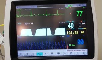 Anaesthetic Monitoring